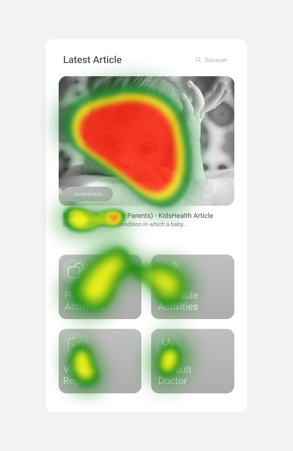 Eyetracking